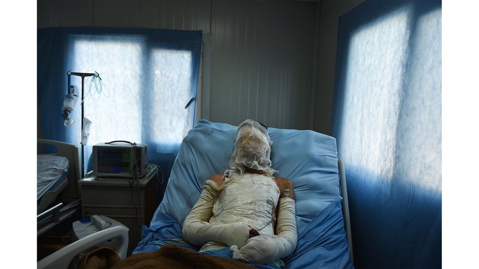 An injured patient in an Iraqi bed with bandages covering his arms, torso and face.