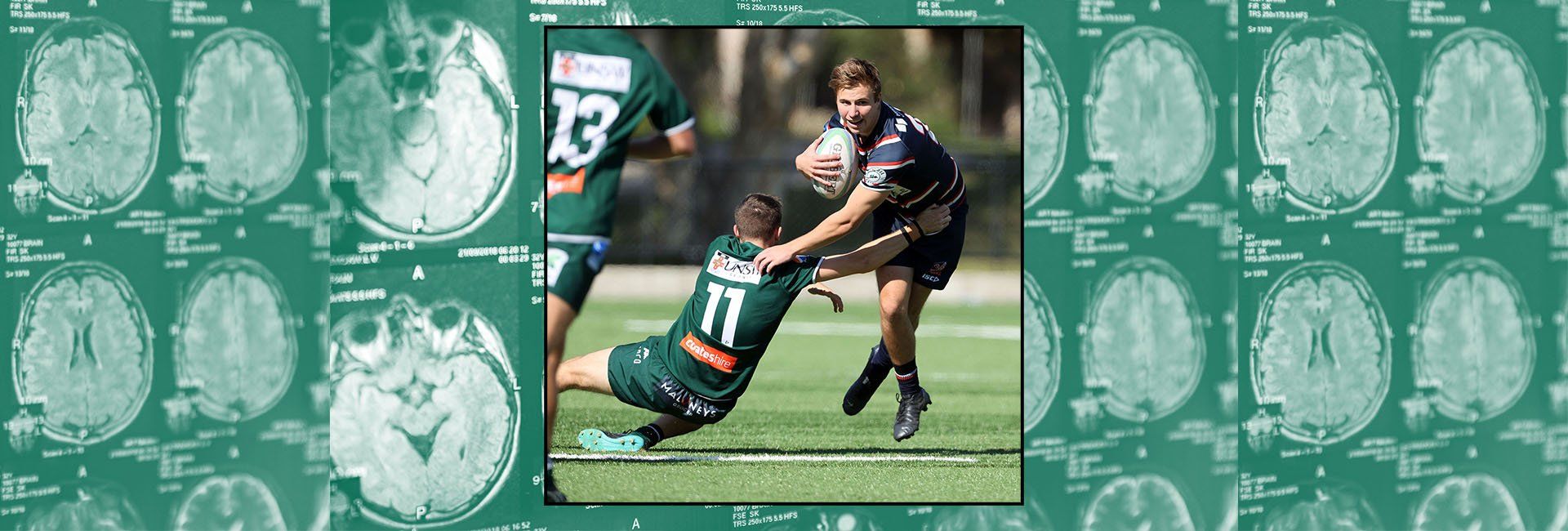 'Dazed and confused': The untold cost of concussion in club level footy